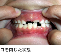 口を閉じた状態
