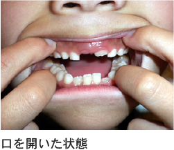 口を開いた状態